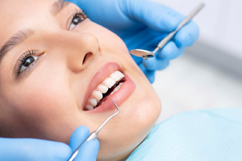 Veneers
